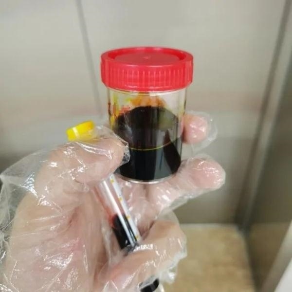 急性肝衰竭！兩兄弟誤吃這種菌 專家提醒